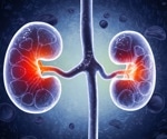 Acute kidney injury doubles dementia risk, study finds