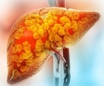Researchers uncover how senescent cells can both harm and heal in liver disease