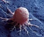 Key reason why some cancers do not respond to immunotherapy identified