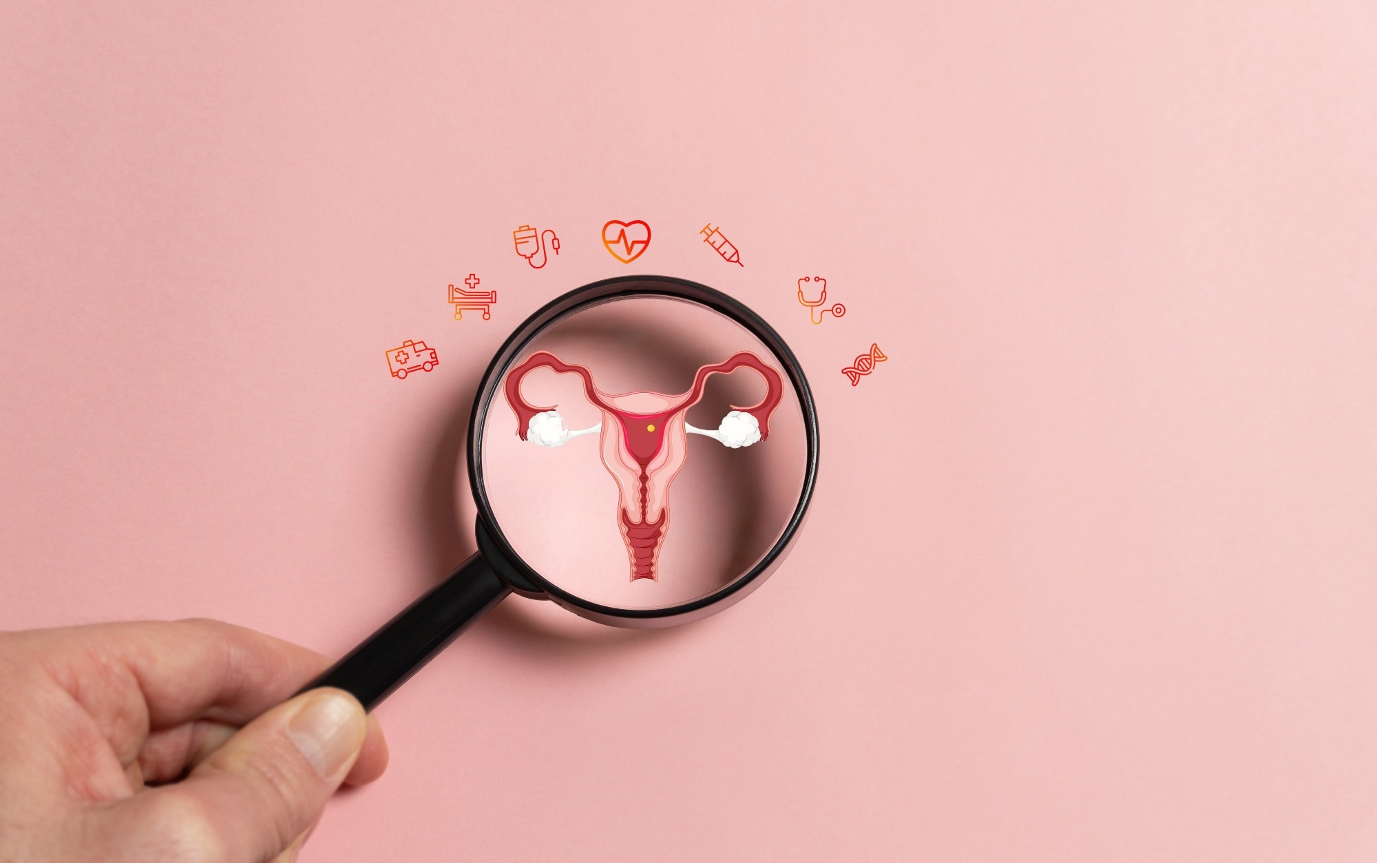 Study: Worldwide patterns and trends in ovarian cancer incidence by histological subtype: a population-based analysis from 1988 to 2017. Image Credit: simonizt / Shutterstock.com