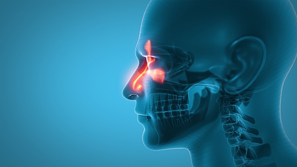 Study: The nasal mycobiome of individuals with allergic rhinitis and asthma differs from that of healthy controls in composition, structure and function. Image Credit: labden/Shutterstock.com