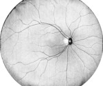 The evolution of OCT for retinal imaging and disease intervention