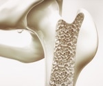 Can yogurt and kefir help prevent osteoporosis? Scientists examine the facts