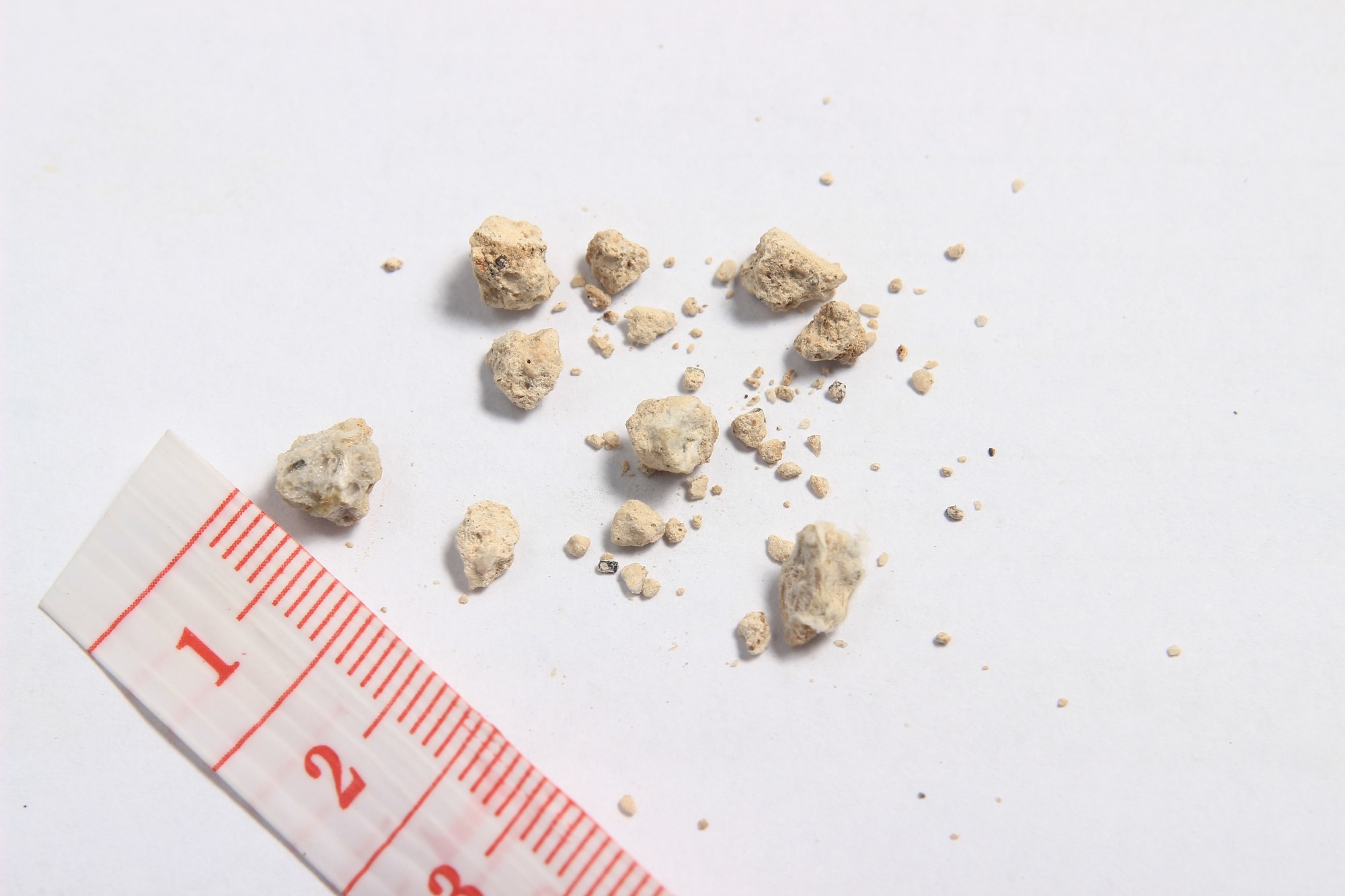 Study: Older age and low testosterone levels are independently associated with kidney stone prevalence in men: results from a large cross-sectional study. Image Credit: Om Yos / Shutterstock