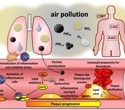 Air pollution fuels artery damage and accelerates heart disease, review finds