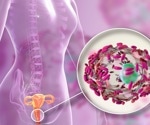 Eating habits directly influence vaginal microbiome, research finds