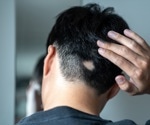 Could serotonin supplements become the next hair loss treatment?