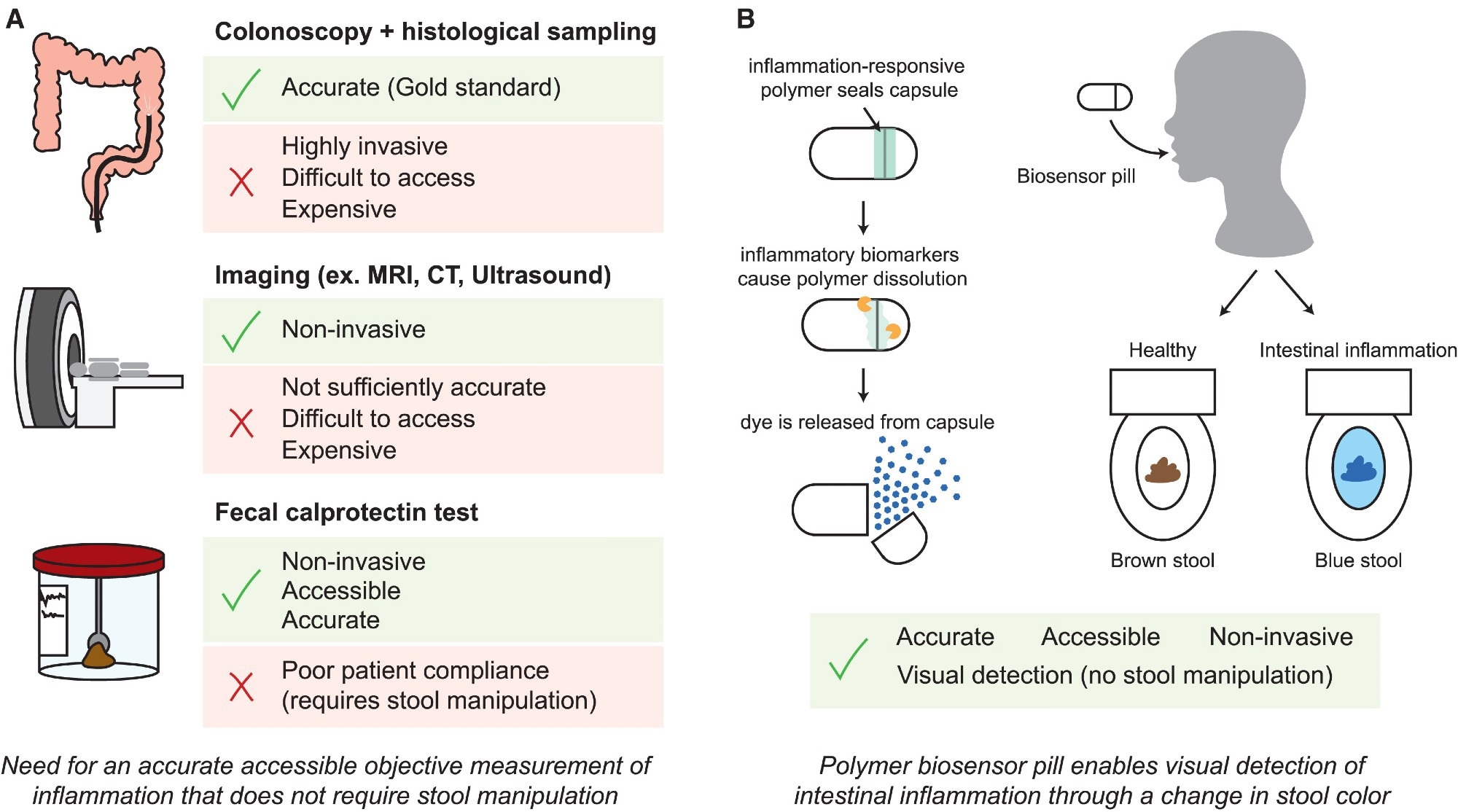 Schematic of modalities for inflammation monitoring in IBD. Study: A radically simple, ingestible colorimetric biosensor pill for cost-effective, non-invasive monitoring of intestinal inflammation