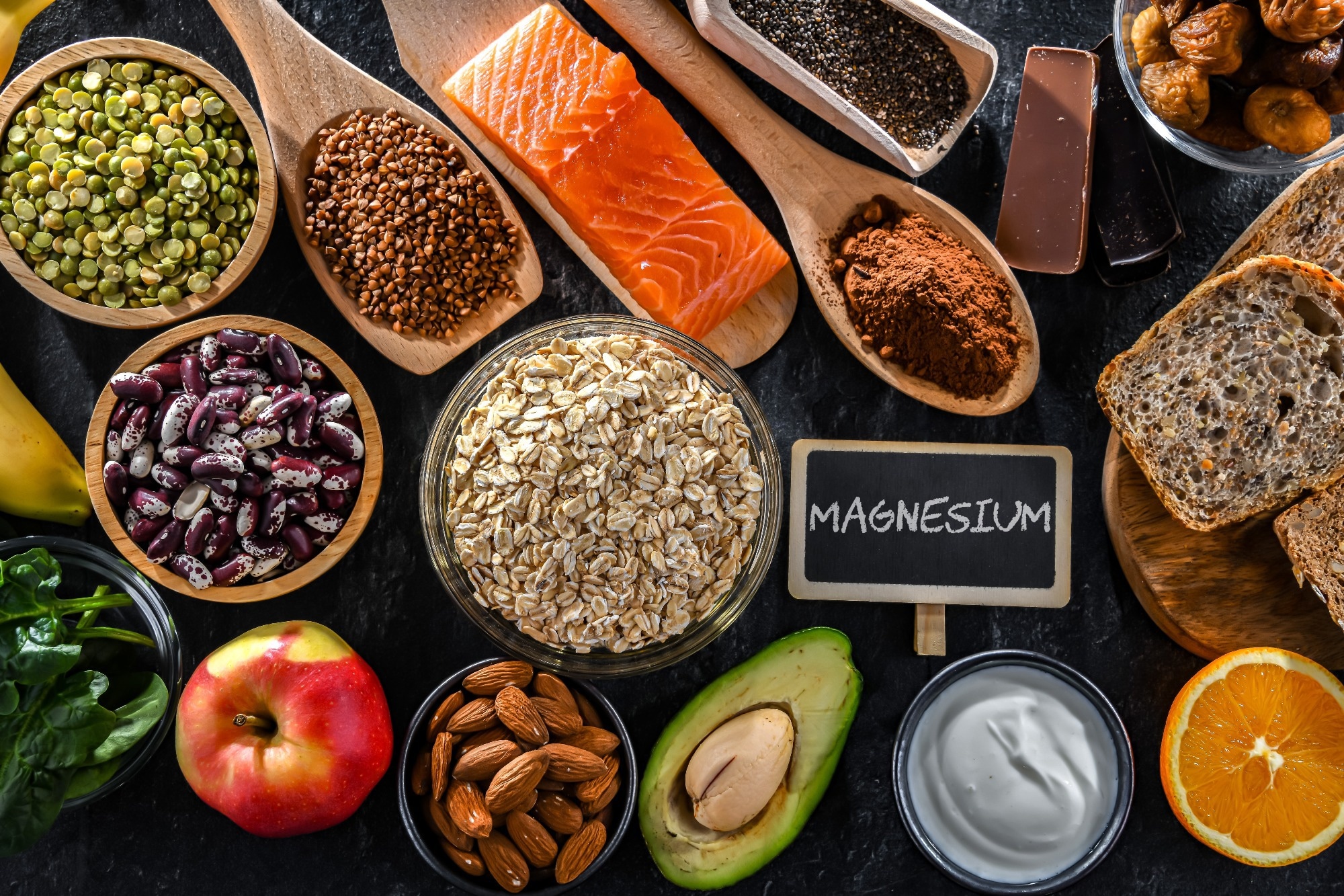 Foods high in magnesium including avocado, salmon and almonds.