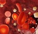 Epigenetic breakthrough: $200 blood test spots diabetes heart risk better than standard tools