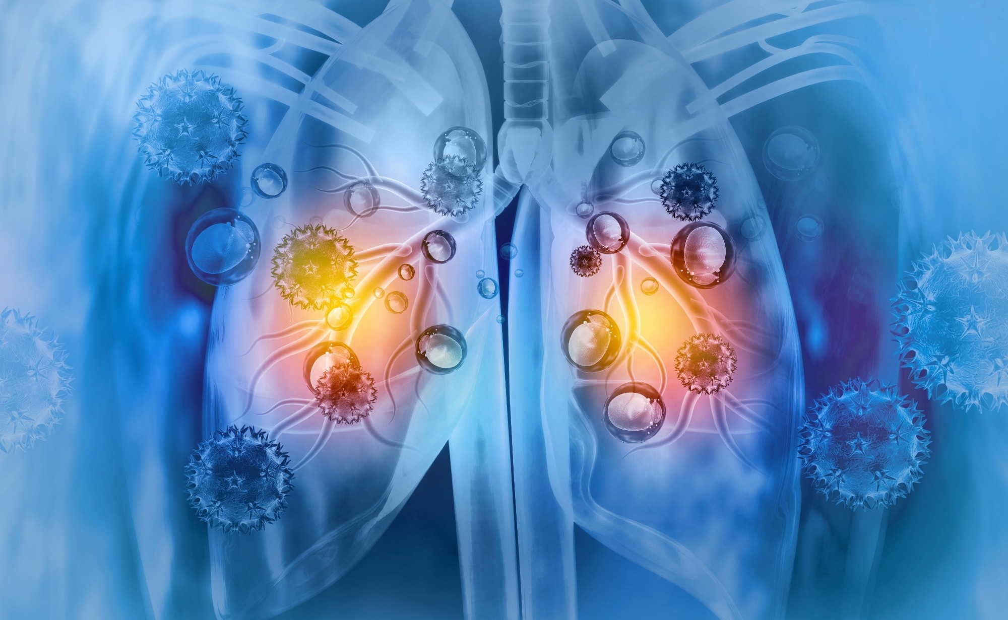 Study: Respiratory viral infections awaken metastatic breast cancer cells in lungs. Image Credit: crystal light / Shutterstock