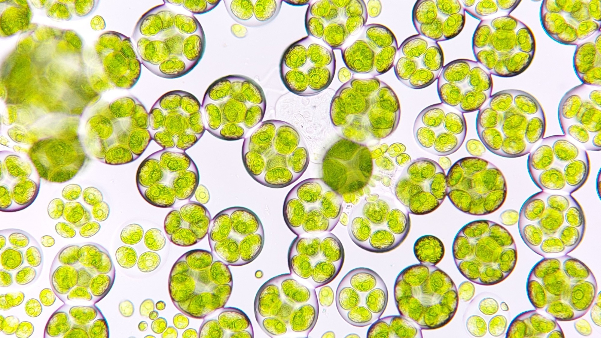 Freshwater microalgae blooming under microscope