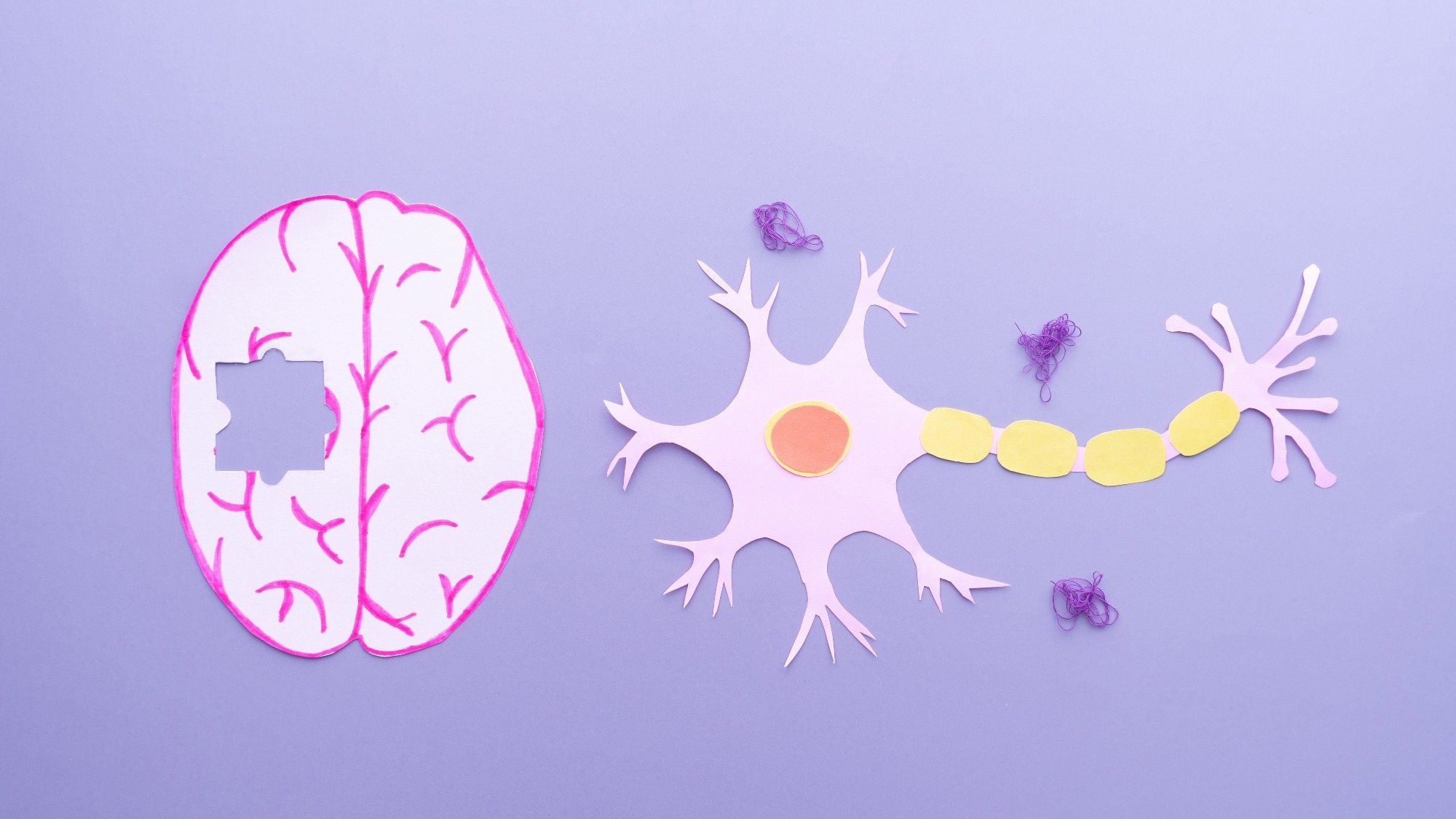 Study: Primary care detection of Alzheimer’s disease using a self-administered digital cognitive test and blood biomarkers. Image Credit: Orawan Pattarawimonchai / Shutterstock