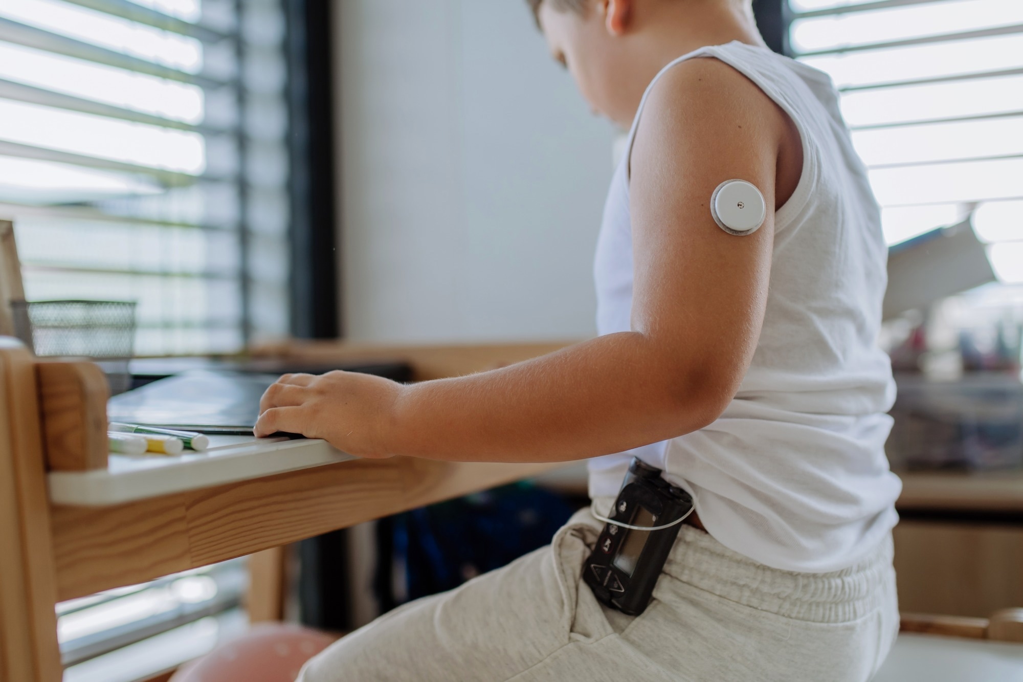Study: Comparison of Metabolic Control, Dietary Habits, Activity, and Psychological Condition in Children and Adolescents Treated with Personal Insulin Pumps. Image Credit: Halfpoint / Shutterstock