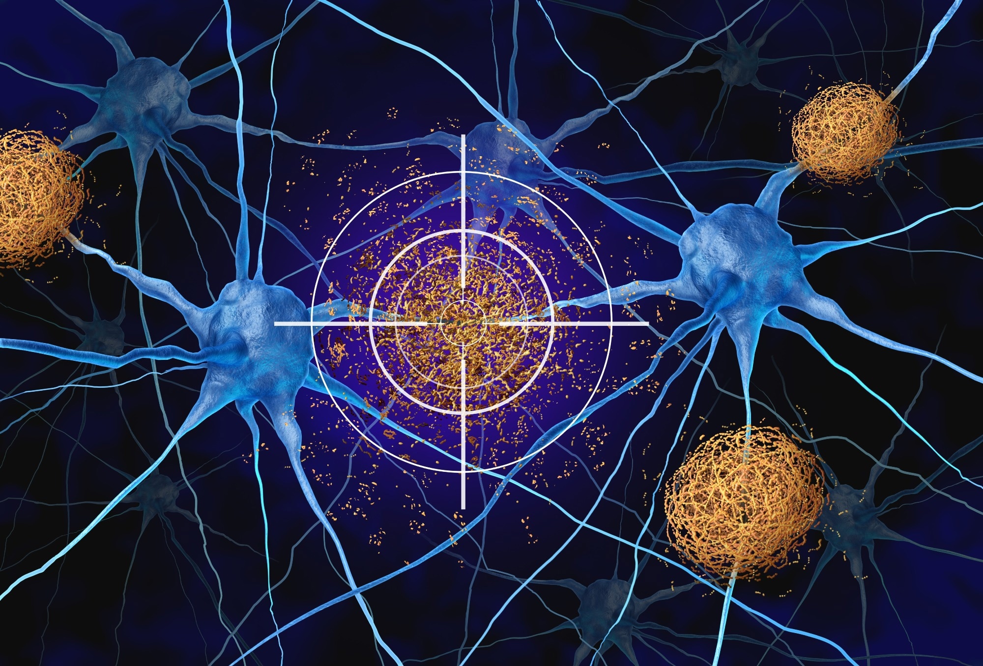 Study: APOE4 to APOE2 allelic switching in mice improves Alzheimer’s disease-related metabolic signatures, neuropathology and cognition. Image Credit: Lightspring / Shutterstock