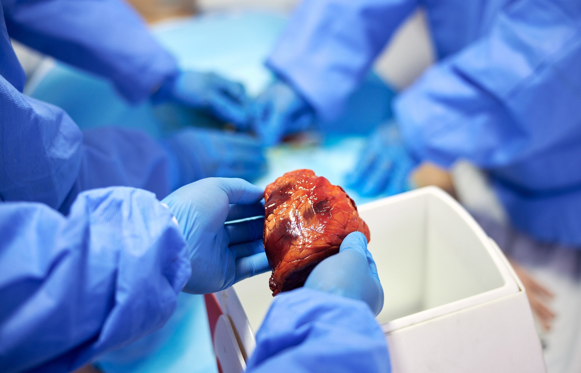 Team of surgeon hands in operating theater for organ donation from injury, accident or emergency