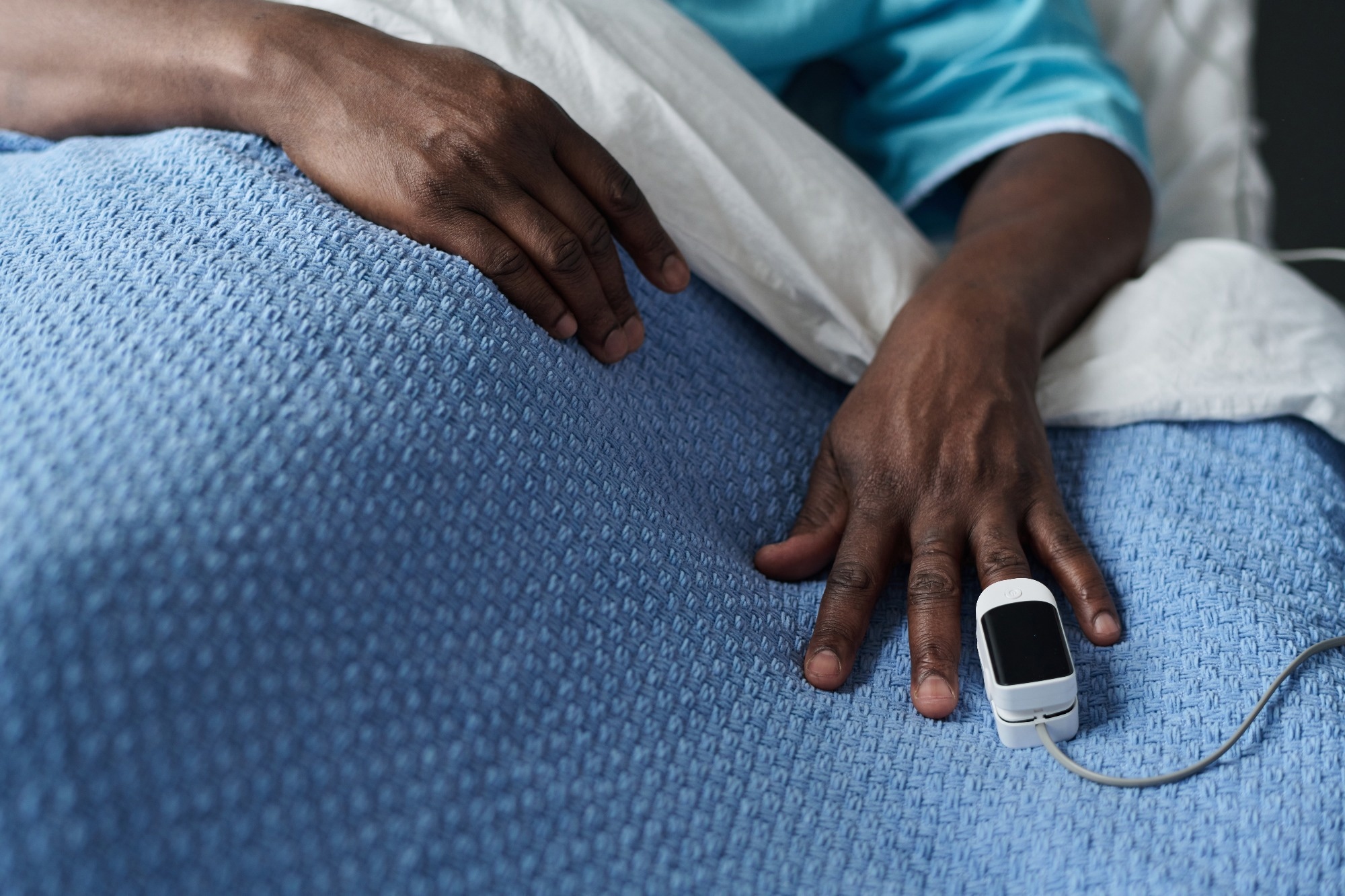 Study: The impact of skin tone on performance of pulse oximeters used by NHS England COVID Oximetry @home scheme: measurement and diagnostic accuracy study. Image Credit: AnnaStills / Shutterstock
