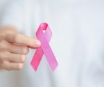 Researchers discover how aggressive breast cancer controls protein production