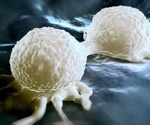 Obesity-driven estrone emerges as a key driver of deadly postmenopausal breast cancer