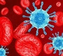 Rapid HIV viral load testing shows mixed effects on seeking care