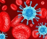 £5m for HIV/AIDS trial involving HIV patients in London, Moscow, South Africa and Australia