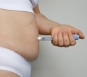 GLP-1 drugs linked to significant BMI reduction in children with severe obesity
