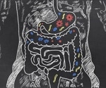 Gut bacteria compound during pregnancy protects offspring from fatty liver disease
