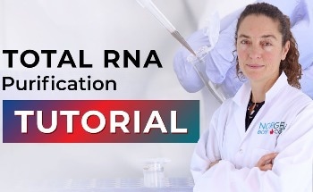 How to Perform Total RNA Purification
