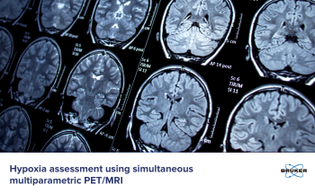 Advanced PET/MRI Techniques for Characterizing Hypoxic Breast Cancer Tumors